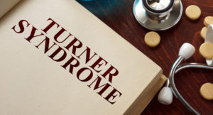 síndrome de Turner